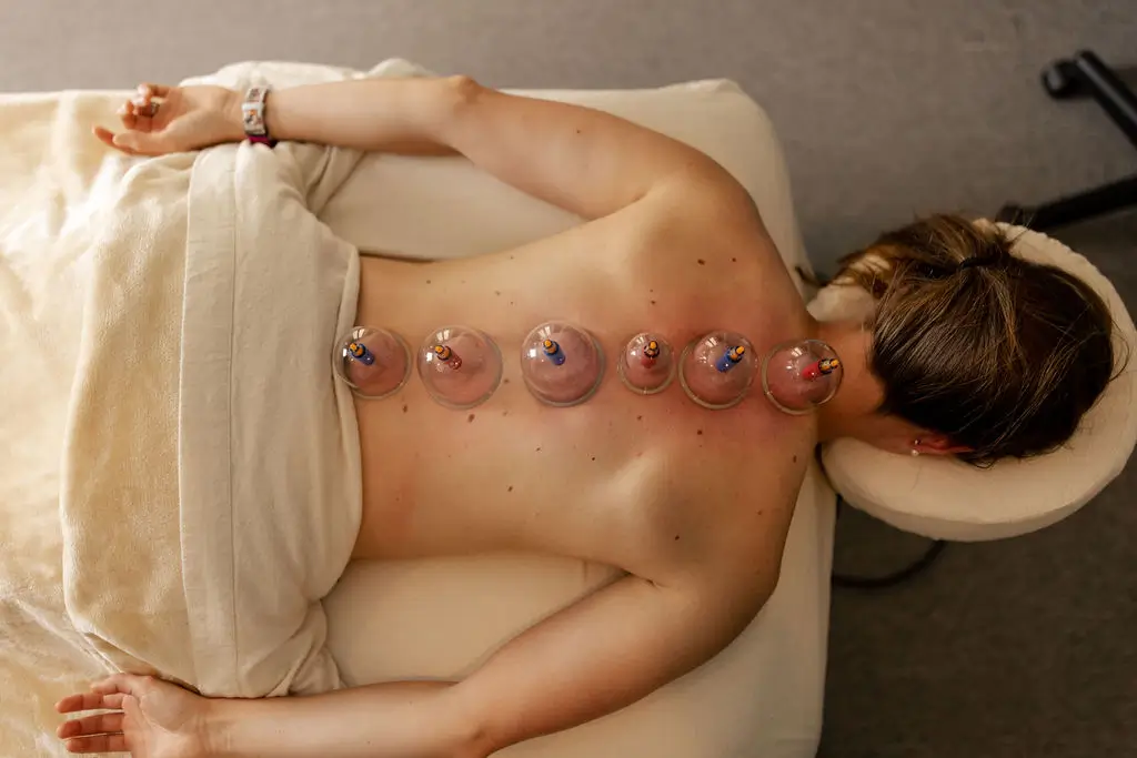 cupping massage therapy in karachi